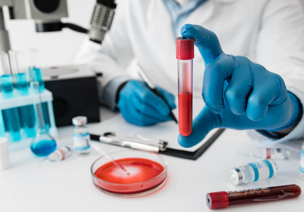 Common Screening Tests
