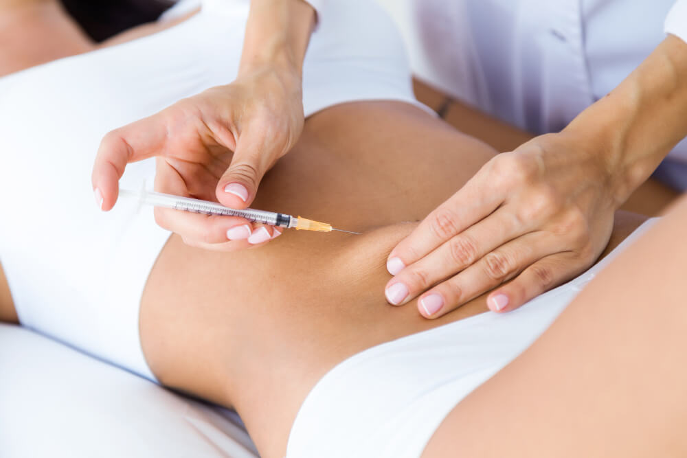 Fat Loss Injections A Potential Treatment for PCOS