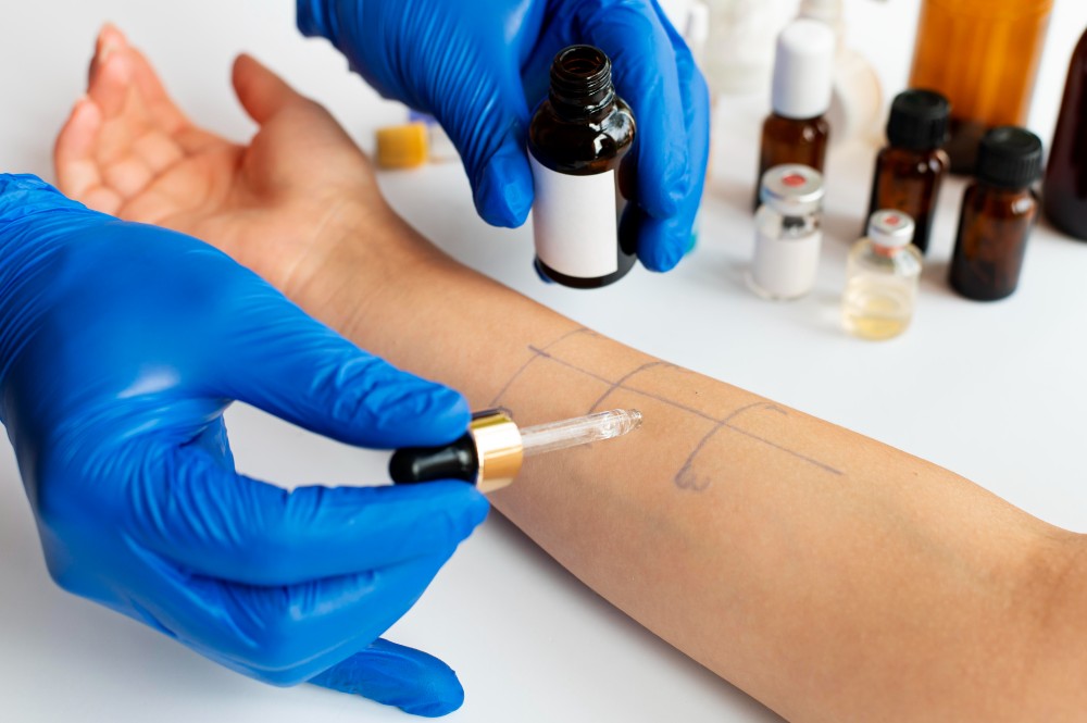 allergy skin testing Odessa TX