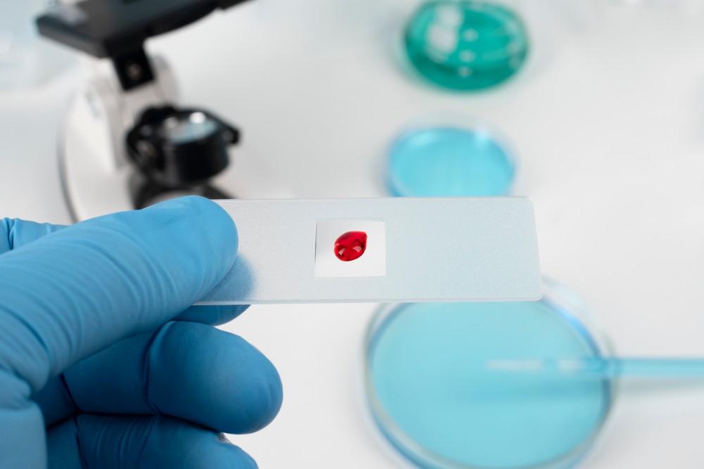 confidential HIV testing Odessa TX